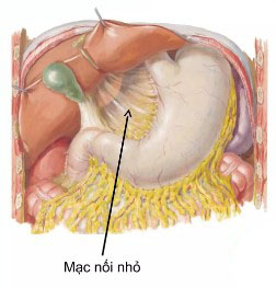 Mạc nối nhỏ có đặc điểm, Ngoại trừ